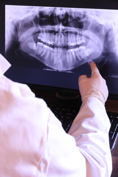 Best Emergency Root Canal Treatment in Willows, CA