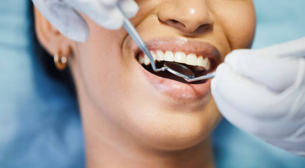 Best Walk-In Emergency Dentist in Willows, CA